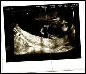 baby 3 ultrasound boy